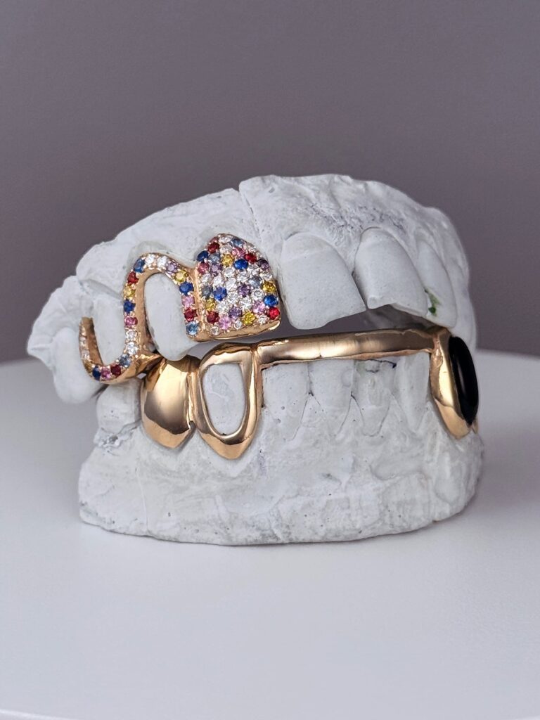 Custom Grillz by Alam Lalani (Grillz by Prince). Photo courtesy of the artist